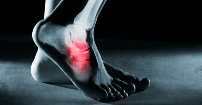 5-common-causes-of-foot-pain-you-should-know